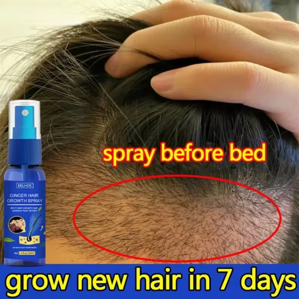 Hair Care Nature - 速効性ジンジャーヘアグローススプレー、毛根育成、脱毛防止、育毛セラム、頭皮ダメージ修復、栄養ケア製品、女性男性用